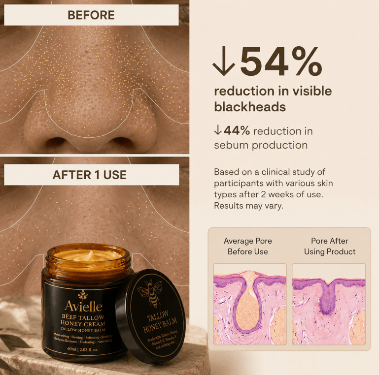 Beef Tallow & Honey Balm