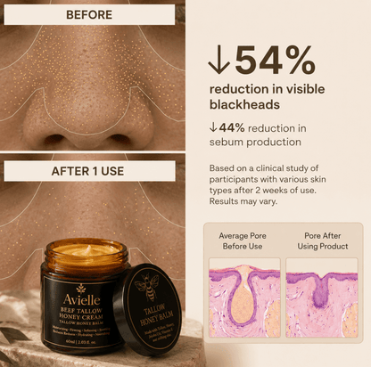 Beef Tallow & Honey Balm